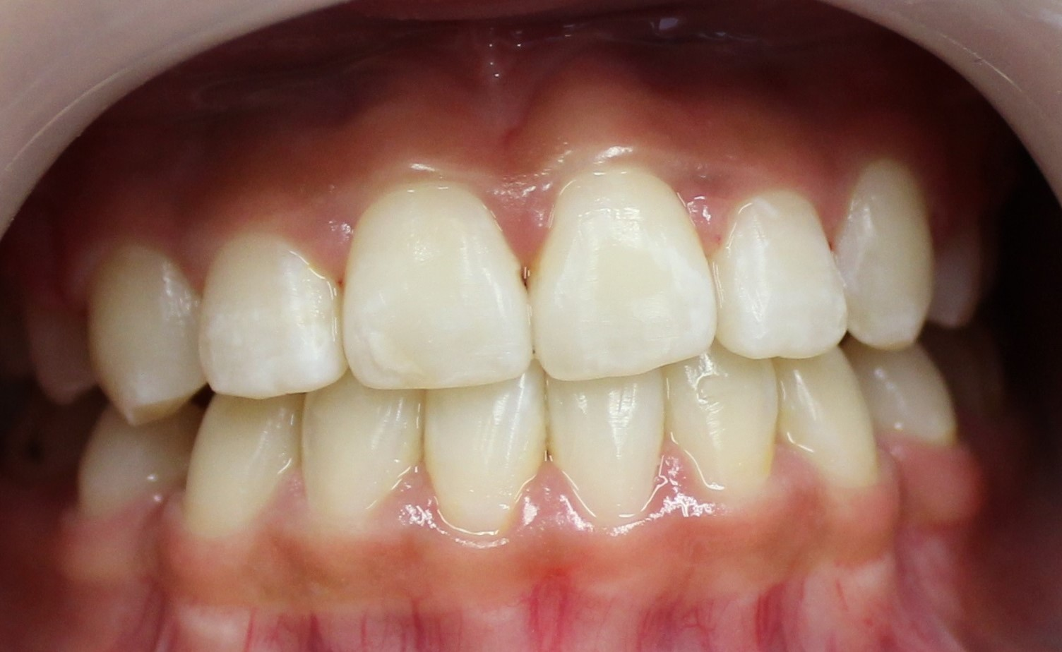 After image