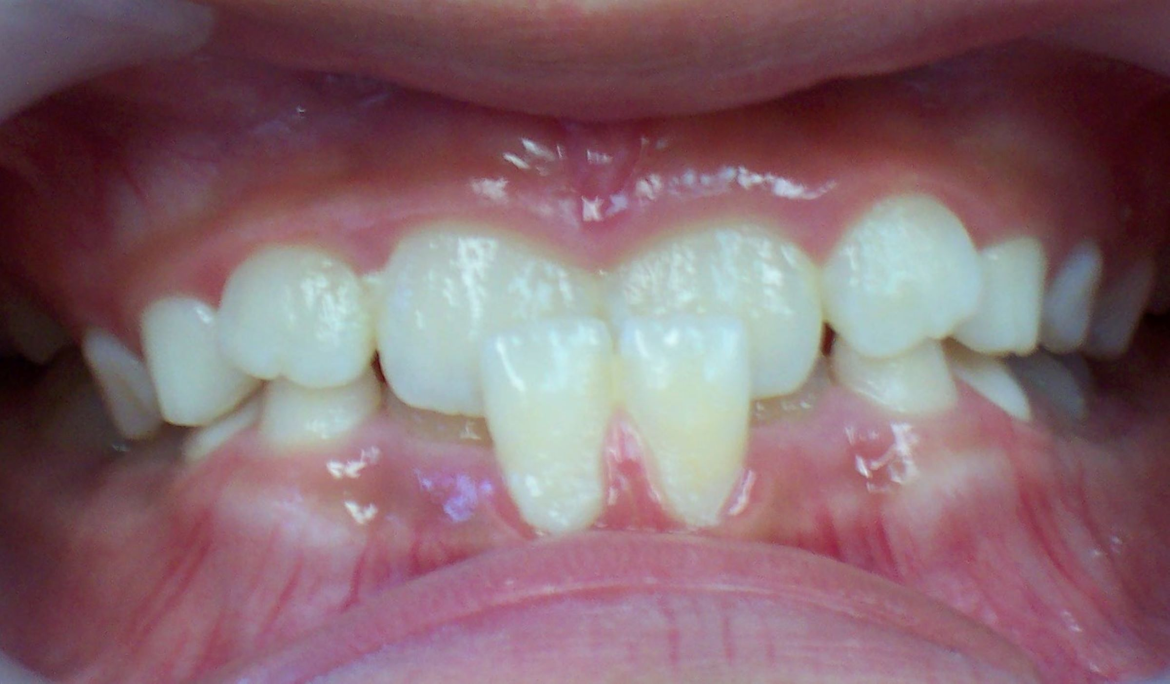 Before image