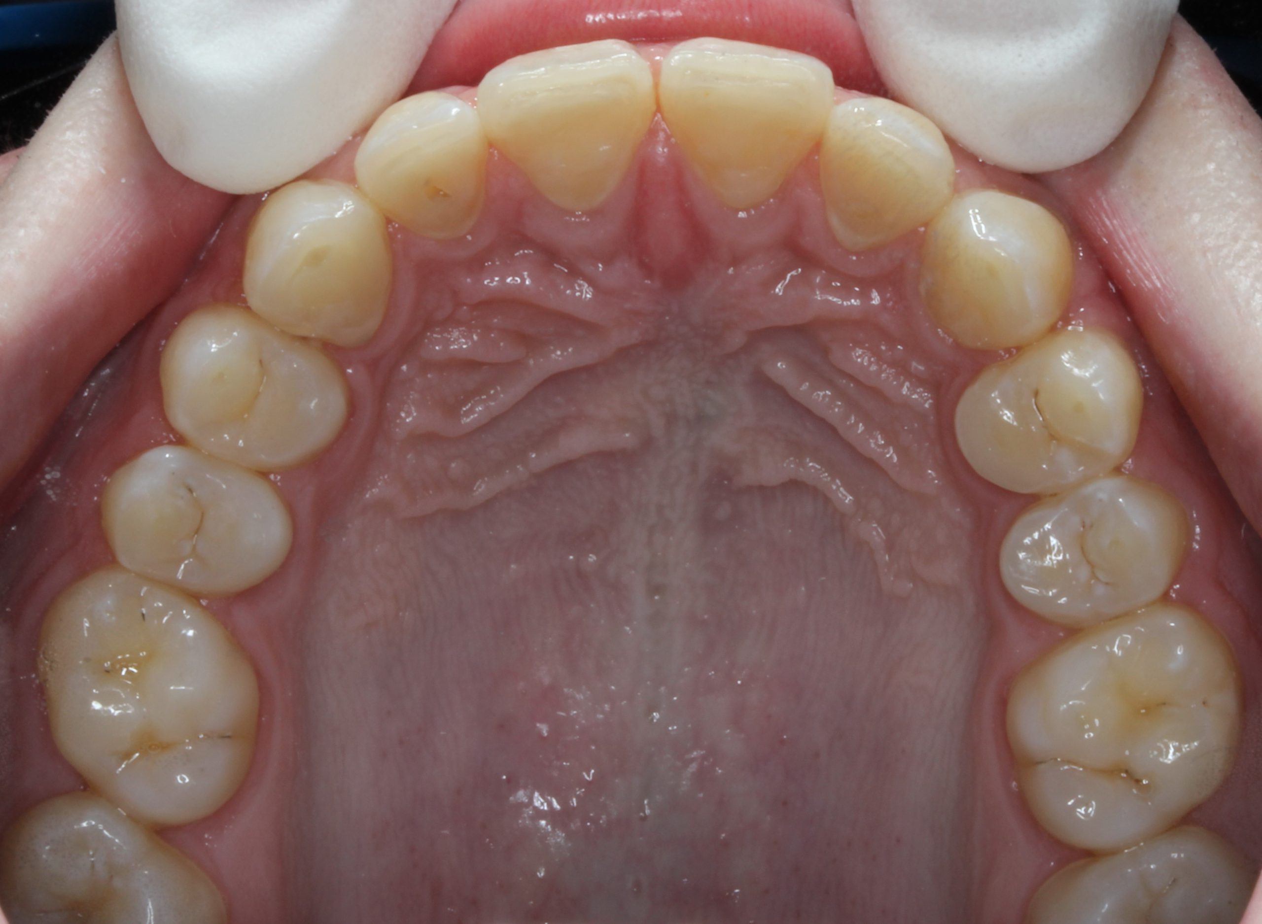 After image
