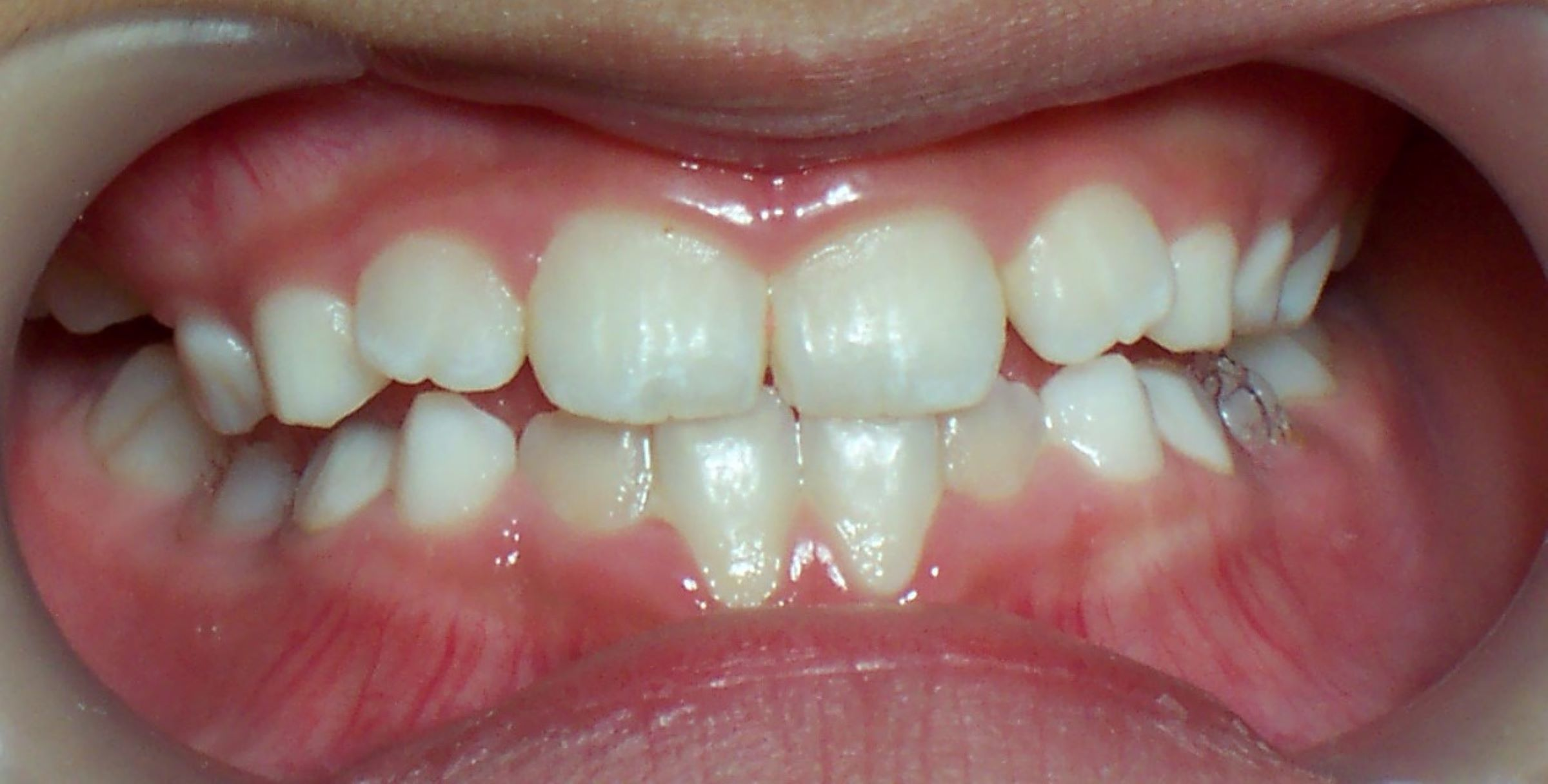 After image