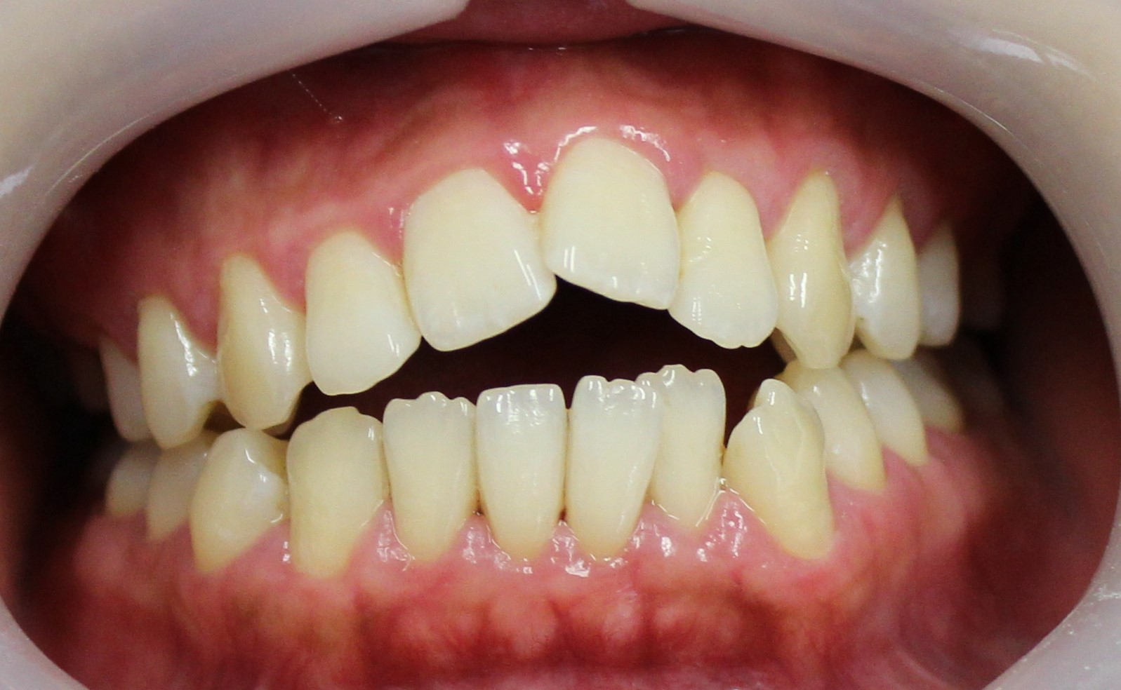 Before image