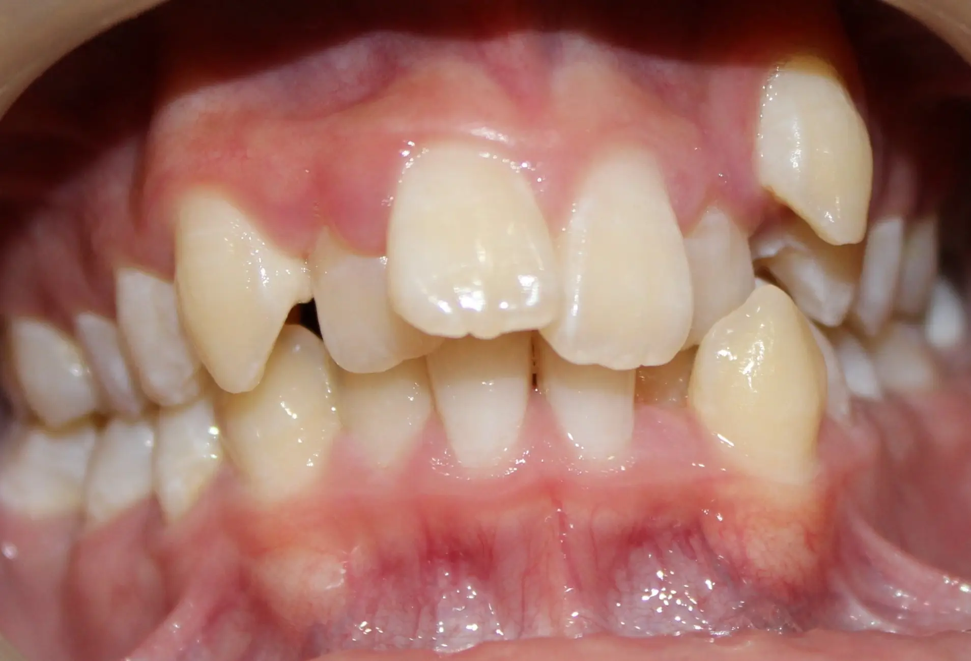 Before image