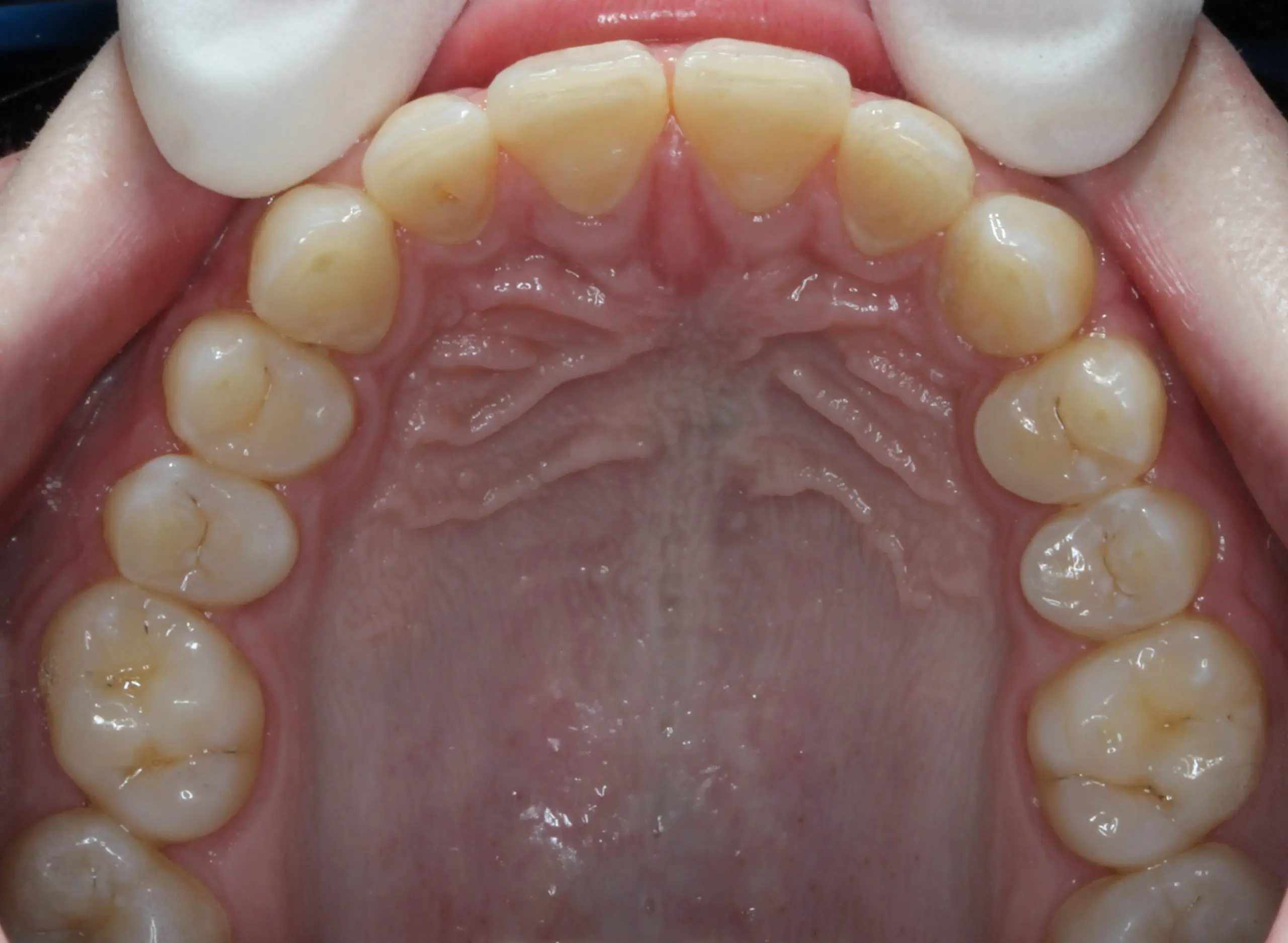 After image