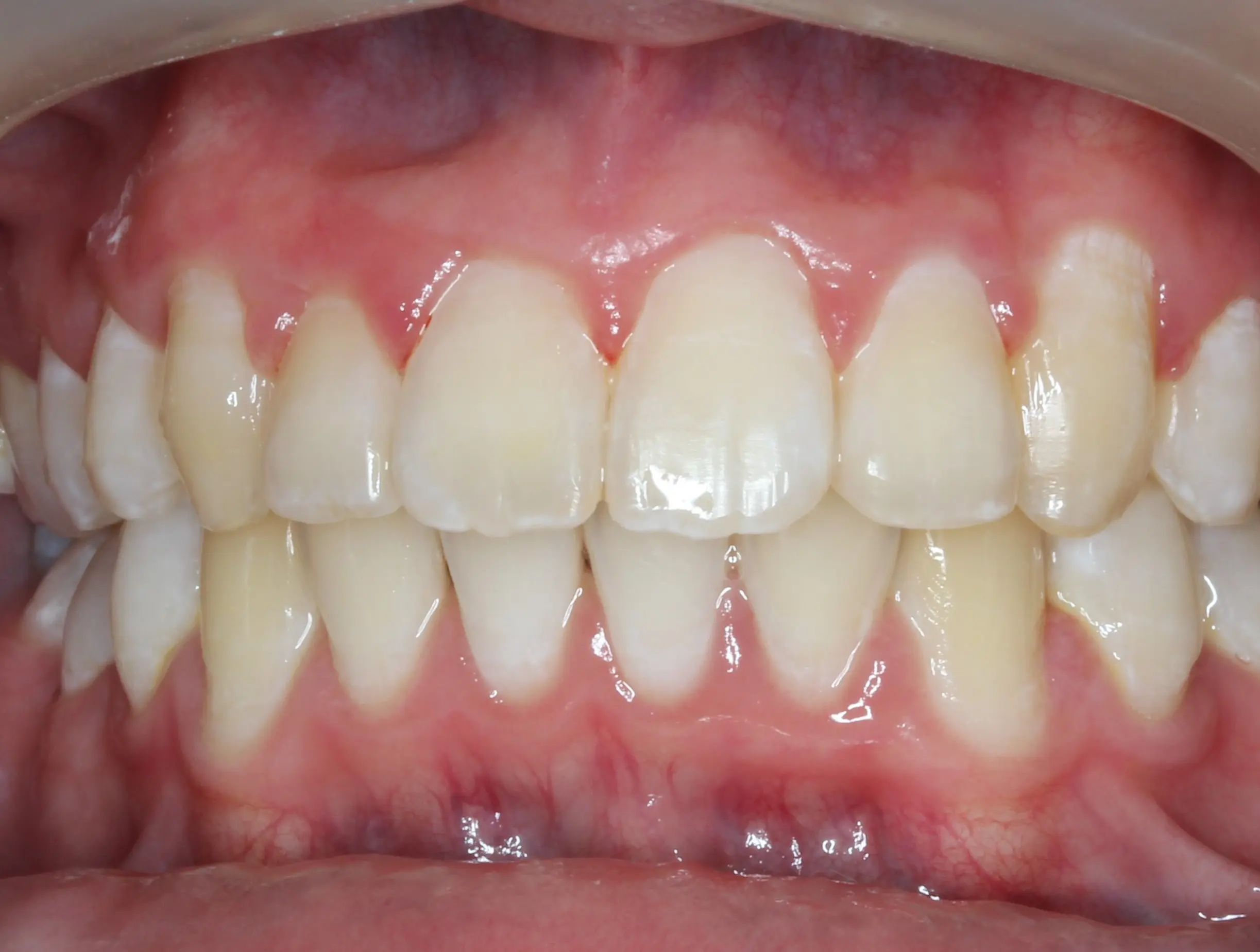 After image