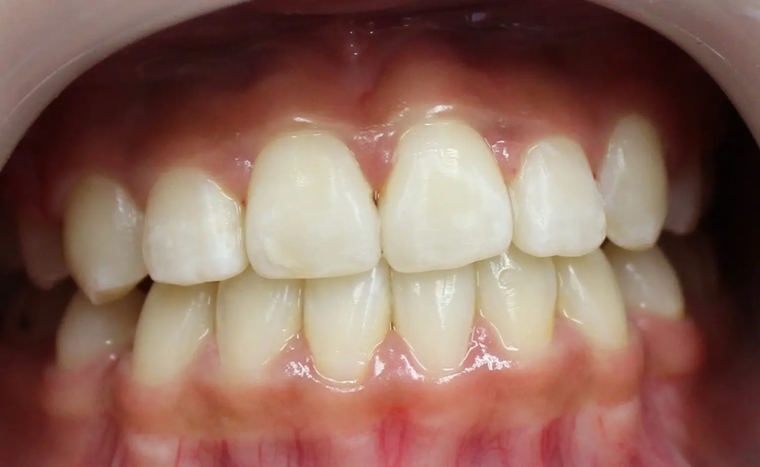 After image