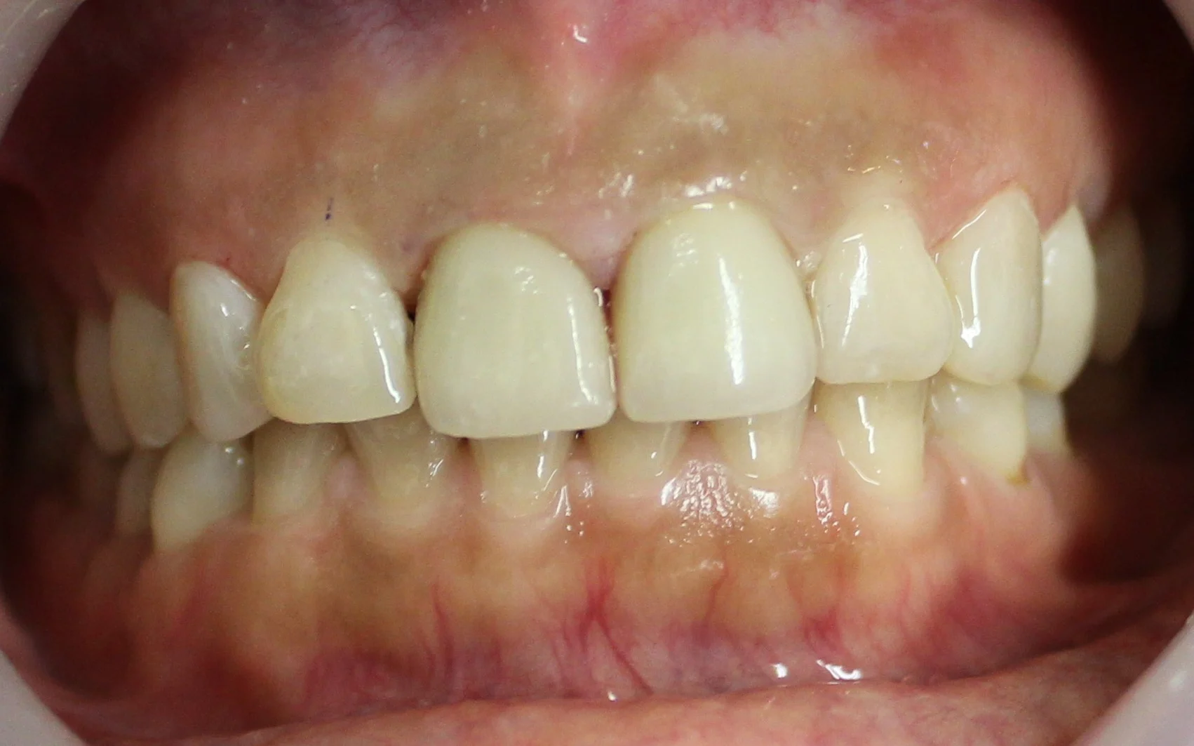 After image
