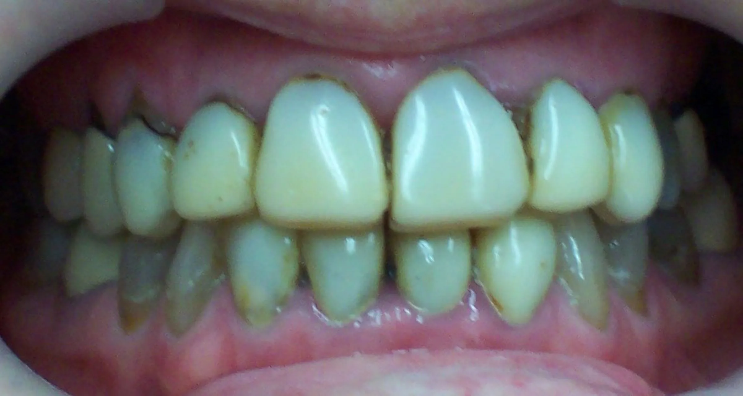 Before image
