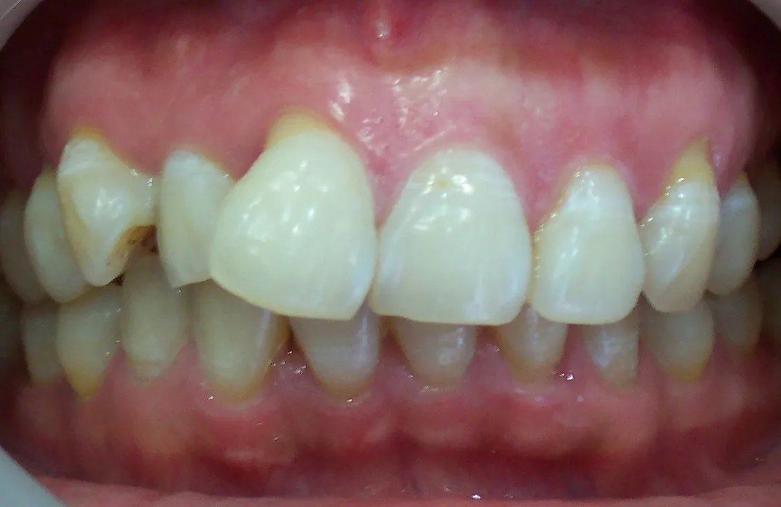 Before image