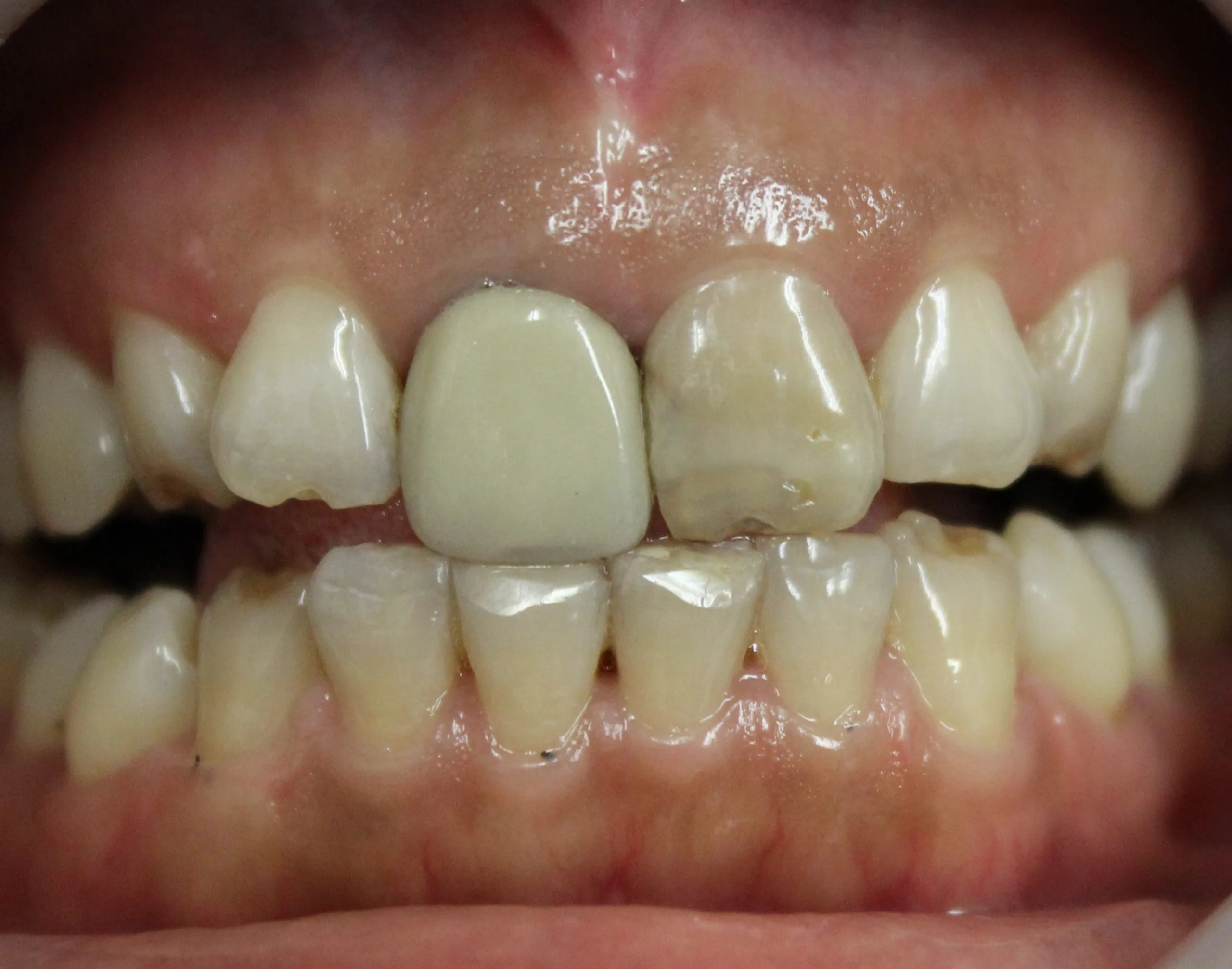 Before image