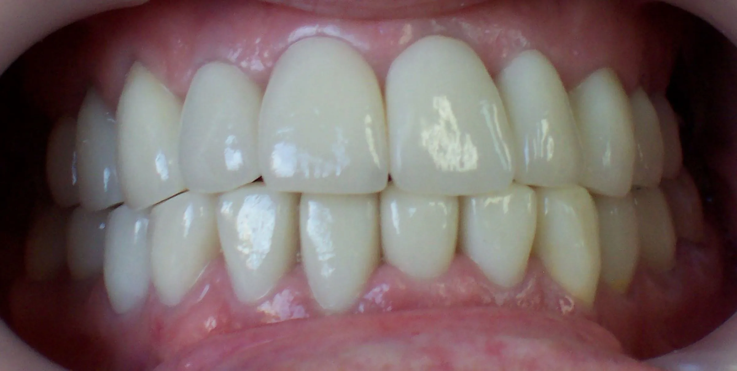 After image