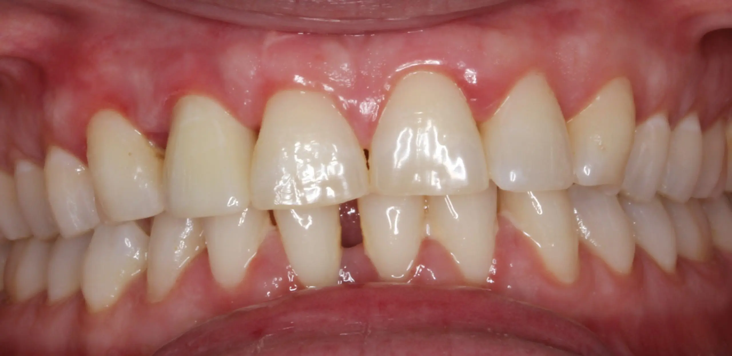 After image