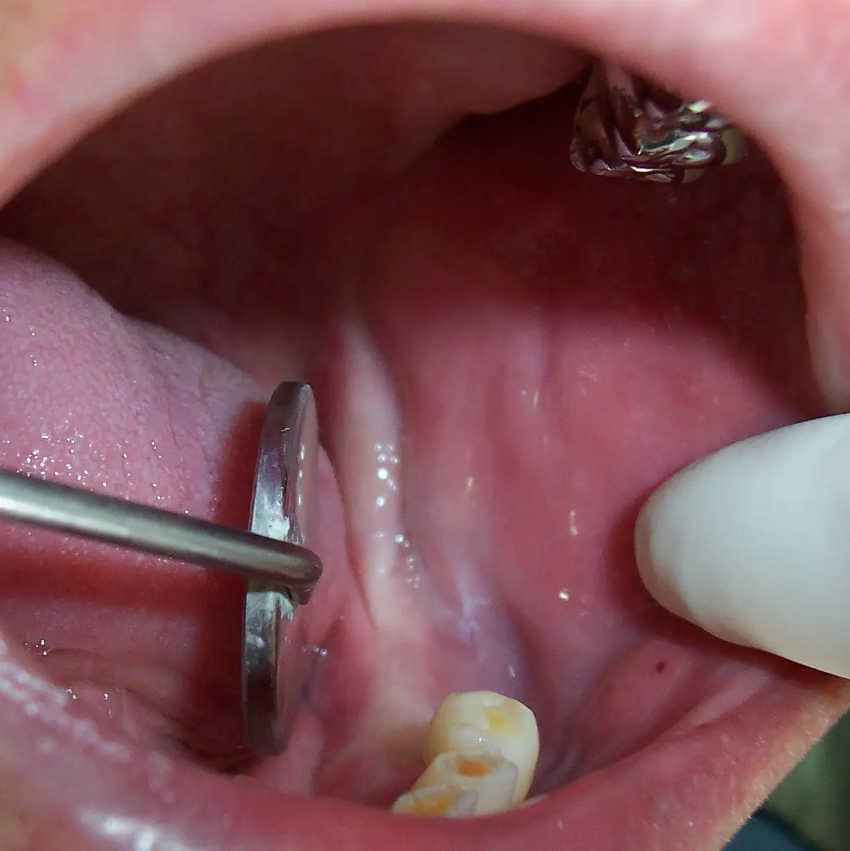 Before image