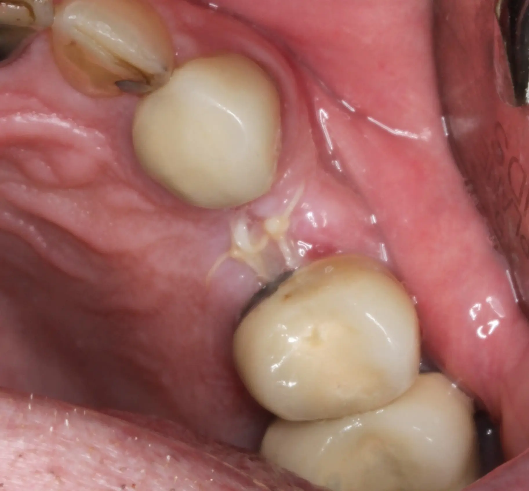 Before image