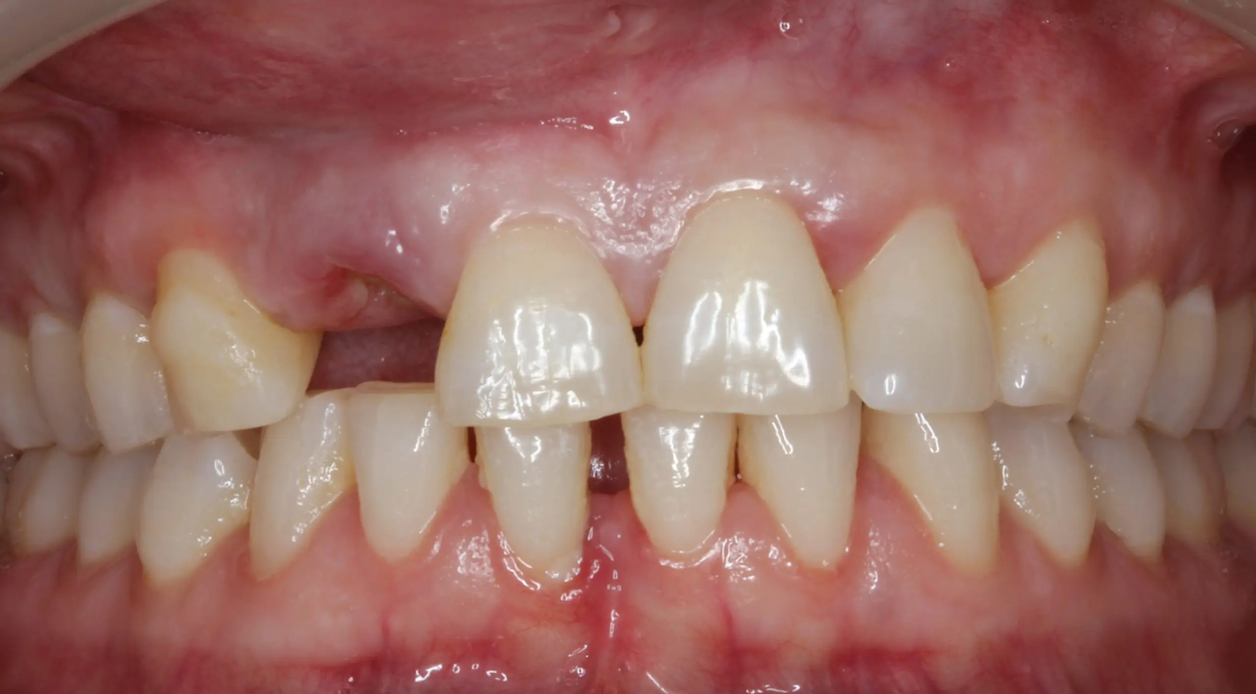 Before image