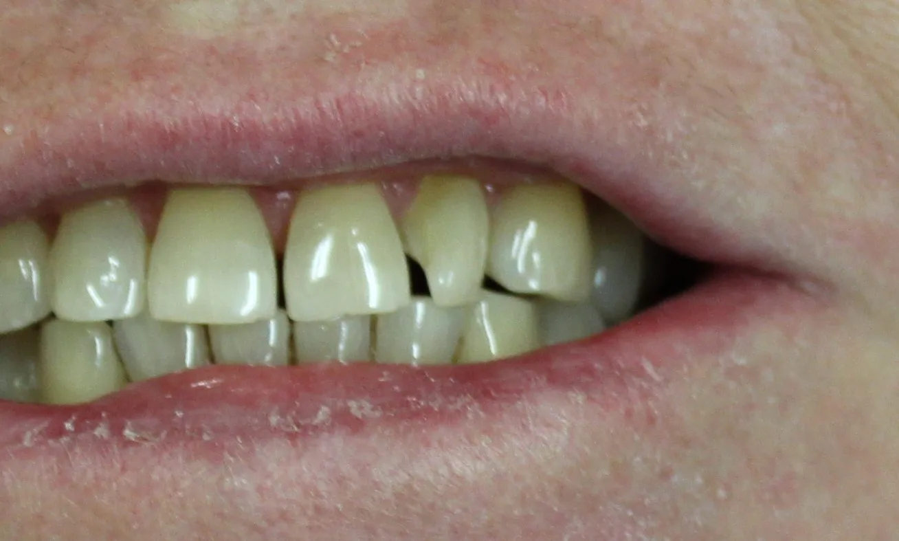 Before image