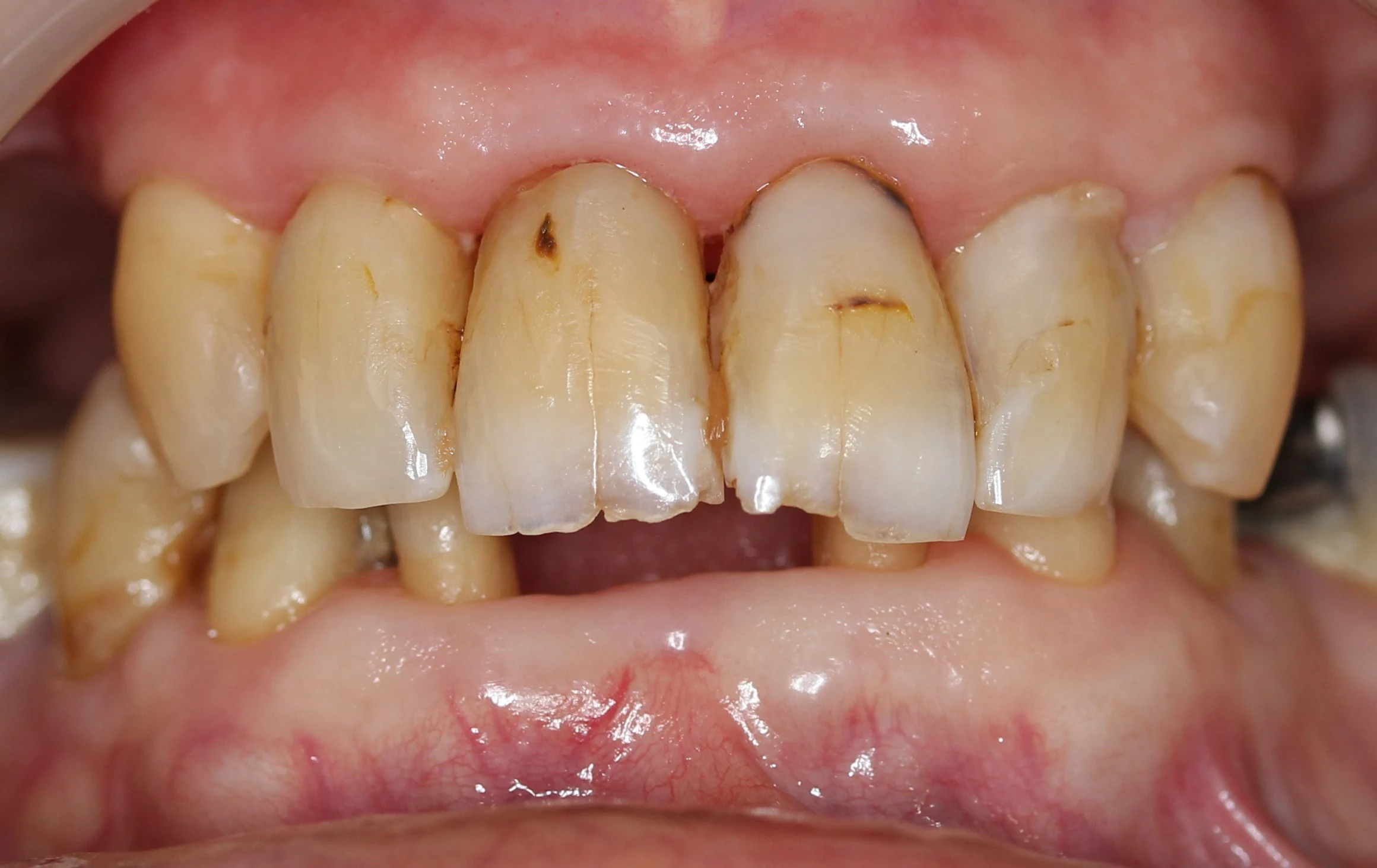 Before image