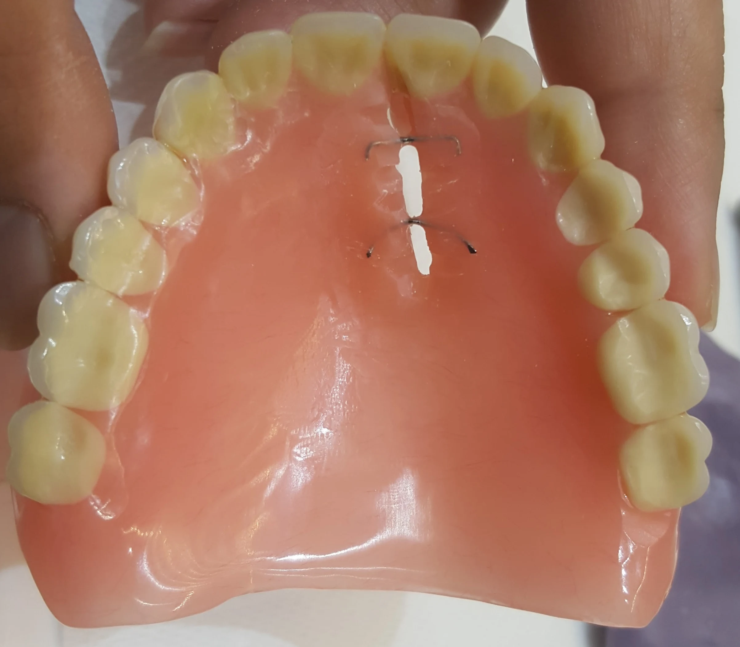 Before image