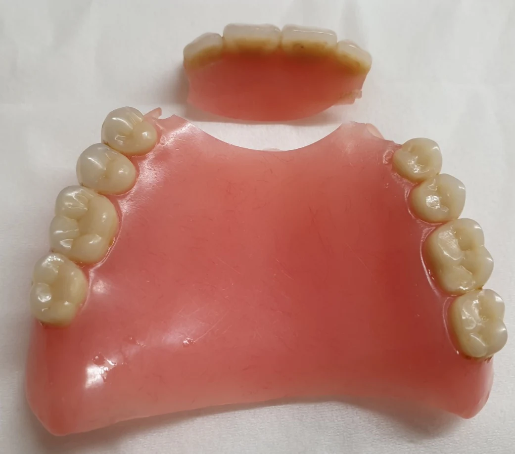 Before image