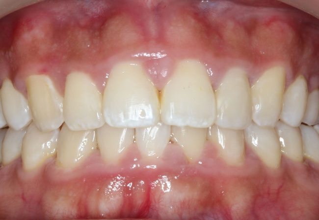 Ortho Case 1 – After