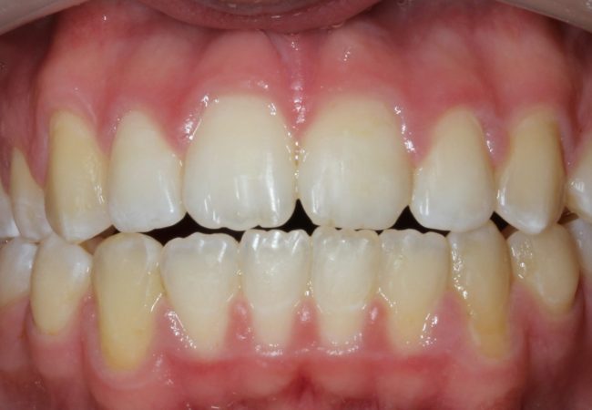 Ortho Case 3 – After