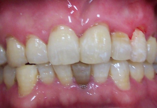 Ortho Case 4 – After