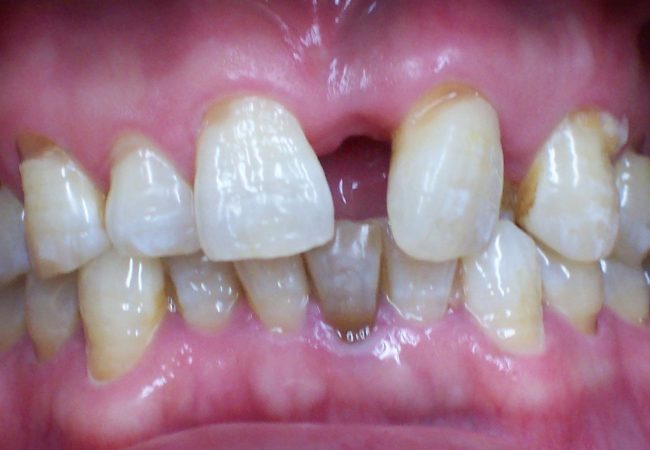 Ortho Case 4 – Before