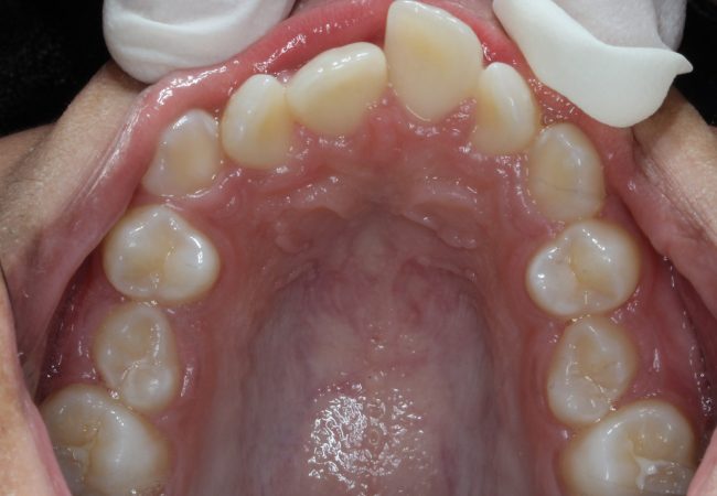 Ortho Case 5 – Before