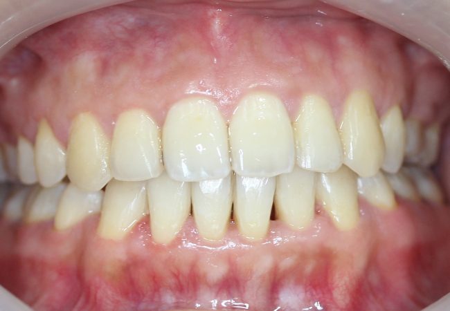 Ortho Case 7 – After