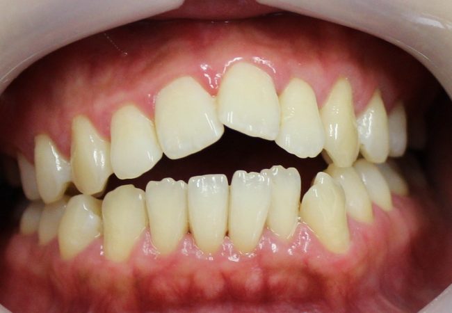 Ortho Case 7 – Before