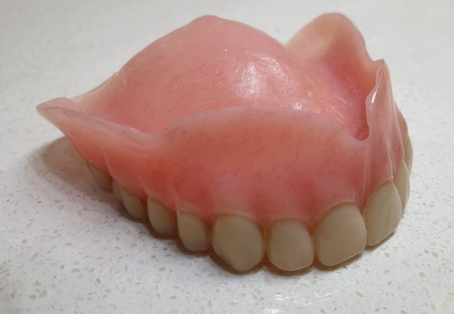 Upper Full Denture